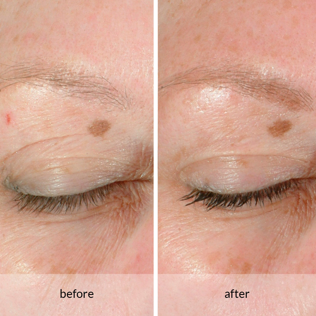 Avon Anew Lifting Dual Eye System 20ml